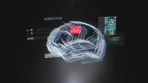 Artificial intelligence Hologram Human Brain scan concept, research Stock Footage 156431235