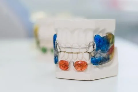 Artificial jaws with a bracket lie on the table Stock Photos