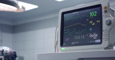 Artificial lung ventilation device. Heart monitor during surgery Stock Footage 166029422