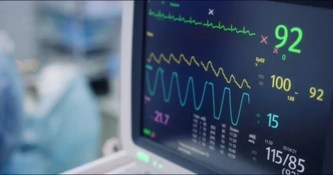 Artificial lung ventilation device. Heart monitor during surgery Stock Footage 166029457