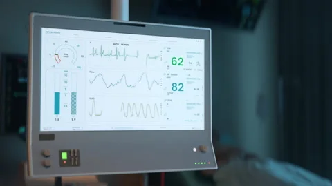 Artificial Lung Ventilation Equipment Alerts Of Death From Breath Rate Decrease 库存影片 202564358