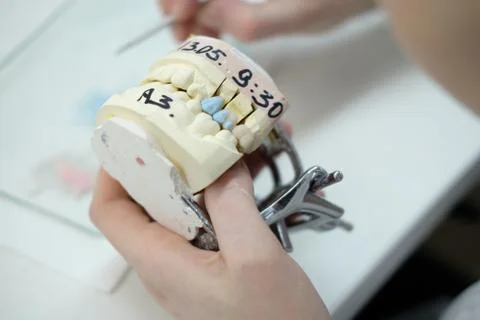 Artificial teeth, prosthetics, hands while working on the denture Stock Photos