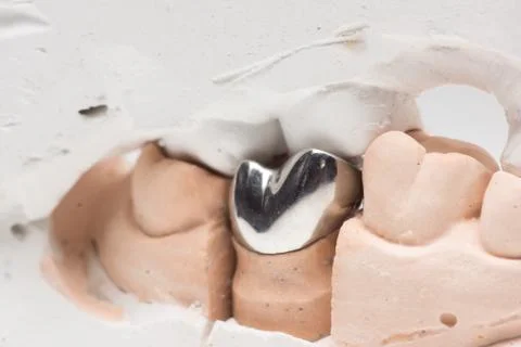 Artificial tooth crown Stock Photos