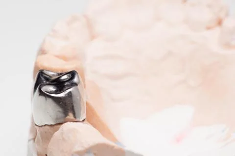 Artificial tooth crown Foto stock