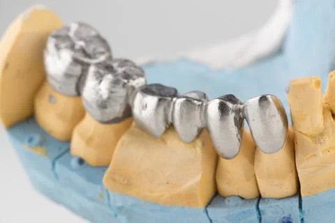 Artificial tooth crown Stock Photos