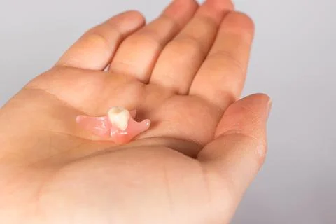 Artificial tooth prosthesis in a person's hand.  Stock Photos