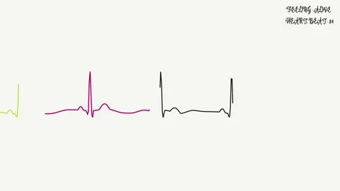 Artistic ecg heart rhythm visualization for diagnostics, Stock Footage 337733067
