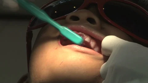 Asian Boy Gets His Teeth Cleaned At The Dentist Stock-Footage 32376829