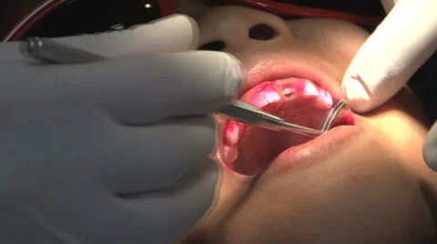 Asian Boy Getting His Teeth Inspected At The Dentist 스톡 동영상 32376825