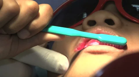 Asian Boy Getting His Teeth Brushed At The Dentist Stock-Footage 32376827