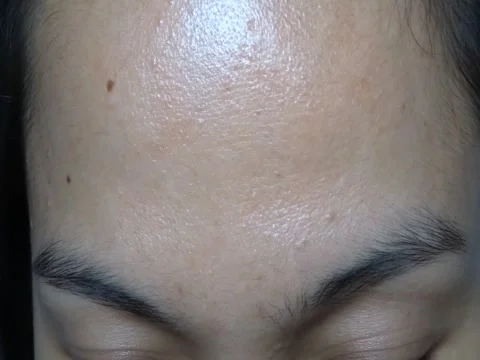 Asian Forehead with Black Eyebrows No Makeup Stock Footage 241635135