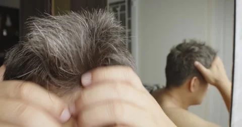 Asian man scratching his head with hoary hair problem. Stock Footage 246628535