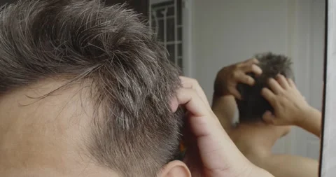 Asian man scratching his head with hoary hair problem. Stock Footage 246997387