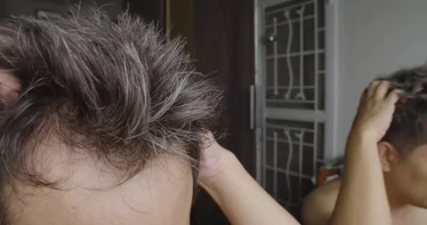 Asian man scratching his head with hoary hair problem. Stock Footage 247356847