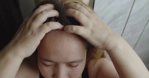 Asian man scratching his head with hoary hair problem. Stock Footage 248508382
