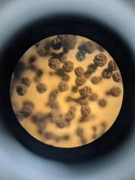 Aspergillus conidia clusters viewed under light microscope showing fungal s.. Stock Photos