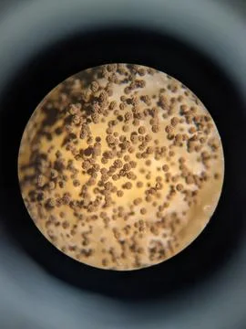 Aspergillus conidia clusters viewed under light microscope showing fungal s.. Stock Photos