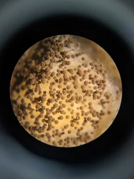 Aspergillus conidia clusters viewed under light microscope showing fungal s.. Stock Photos