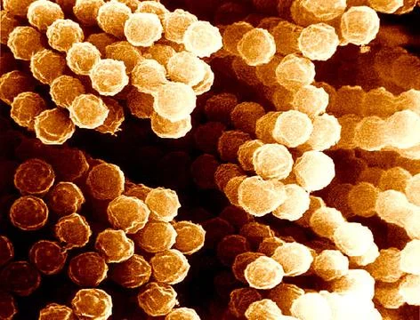  Aspergillus sp Scanning electron micrograph of Aspergillus species. Asper... Stock Photos