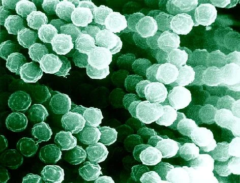  Aspergillus sp Scanning electron micrograph of Aspergillus species. Asper... Stock Photos