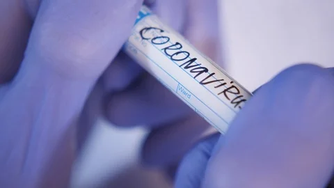 Assistant in gloves holds coronavirus sample in test tube Stock Footage 124616492