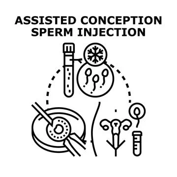 Assisted conception ivf fertilization injecting sperm cells Stock Illustration