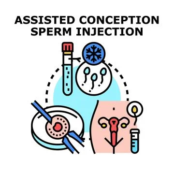 Assisted conception ivf fertilization injecting sperm cells Stock Illustration