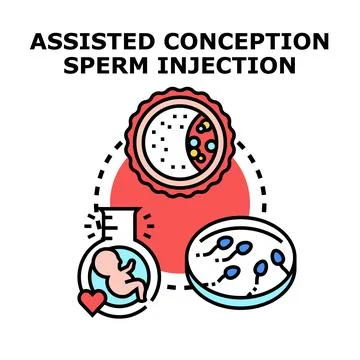 Assisted conception medical procedure visualizing pregnancy hope Stock Illustration