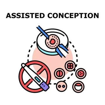Assisted conception medical treatment process for infertility Stock Illustration