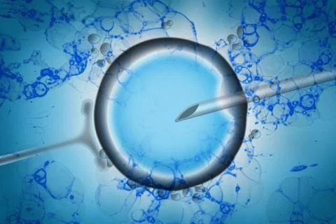 Assisted reproductive technology in fertility treatment Stock Photos