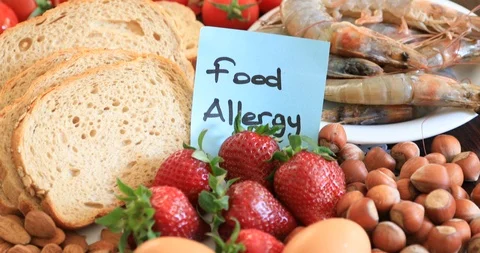 Assorted allergy food 7 Video stock 88994585