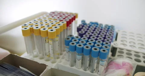 Assorted Medical Test Tubes Arranged on a Laboratory Rack Stock Footage 284128062