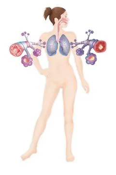 Asthma, drawing Stock Illustration