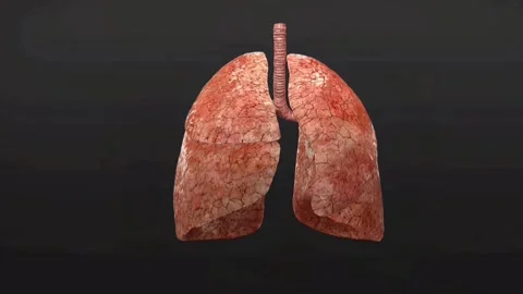 Asthmatic lungs Stock Footage 294376257