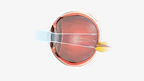 Astigmatism is a type of refractive error. Astigmatism occurs when the cornea or Stock Footage 246053092