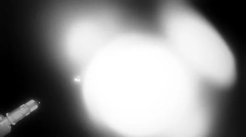 Asylum Needle Stock Footage 35192765