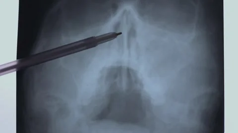 Asymmetry 스톡 동영상 296407111