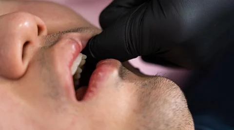 ATM technique pushing pressure points inside the mouth to relief pain Stock Photos
