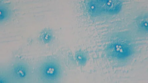 Atmospheric Nitrogen (N2) fixation. Nitrogen-fixing bacteria convert atmospheric Stock Footage 268488776
