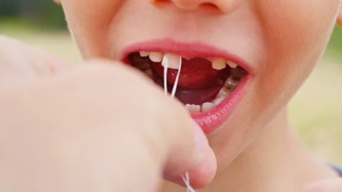 An attempt to pull out a baby tooth to a boy with dental floss. Taken in close Stock Footage 255860269