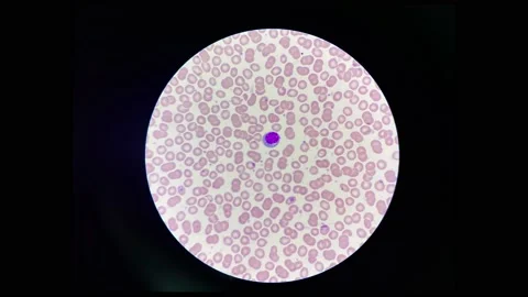 Atypical lymphocyte stop motion. 스톡 동영상 231761027