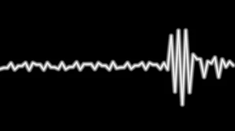 Audio line 2 Stock Footage