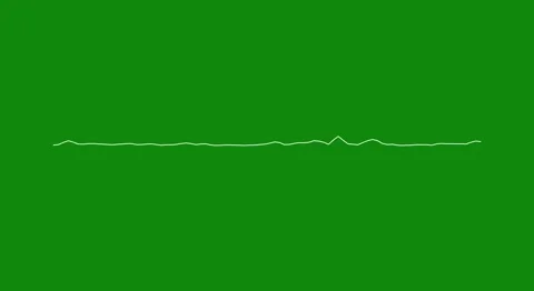 Audio waveform spectrum animation.line digital minimalist sound wave animation, Stock Footage 314878365