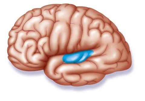  Auditory cortex Auditory area. Localization of the auditory area (in blue... Stock Photos