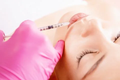 Augmentation form of lips. Beautiful young woman mouth receiving hyaluronic acid 스톡 사진