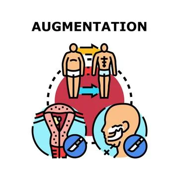 Augmentation surgery process for body and facial procedures Stock Illustration