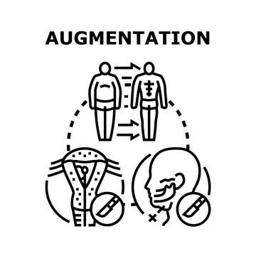 Augmentation surgery process for body and facial procedures Stock Illustration