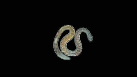 Aulophorus sp worm under a microscope, family Naididae. Stock Footage 156172151
