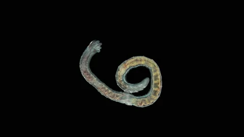 Aulophorus sp worm under a microscope, family Naididae. Video stock 156183437