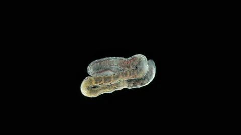 Aulophorus sp worm under a microscope, family Naididae. Stock Footage 156183521